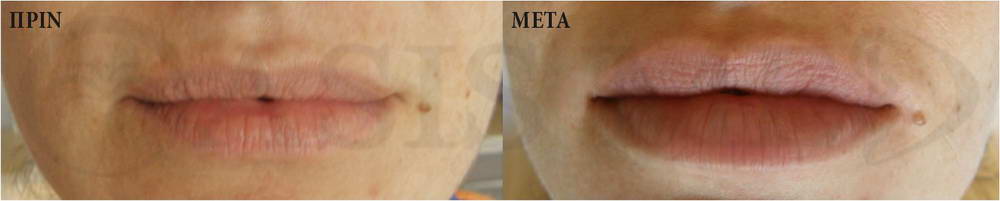 before after 3
