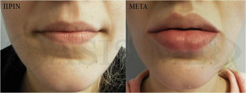 before after 7