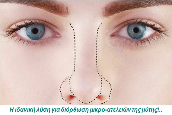 Μη Επεμβατική Ρινοπλαστική 1