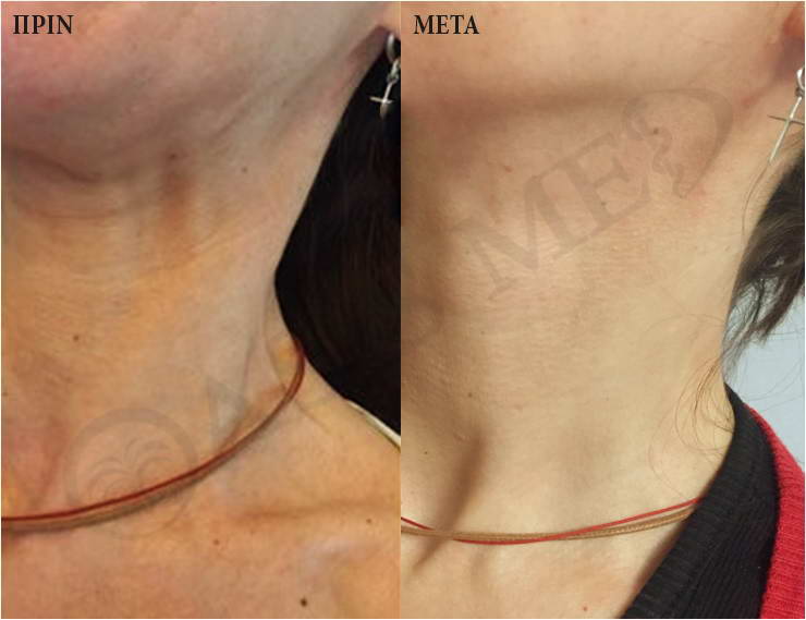 before after 3