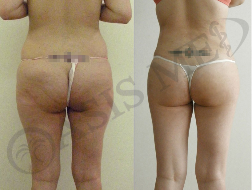 before after 3