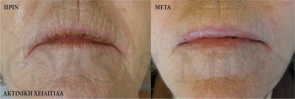 before after 2