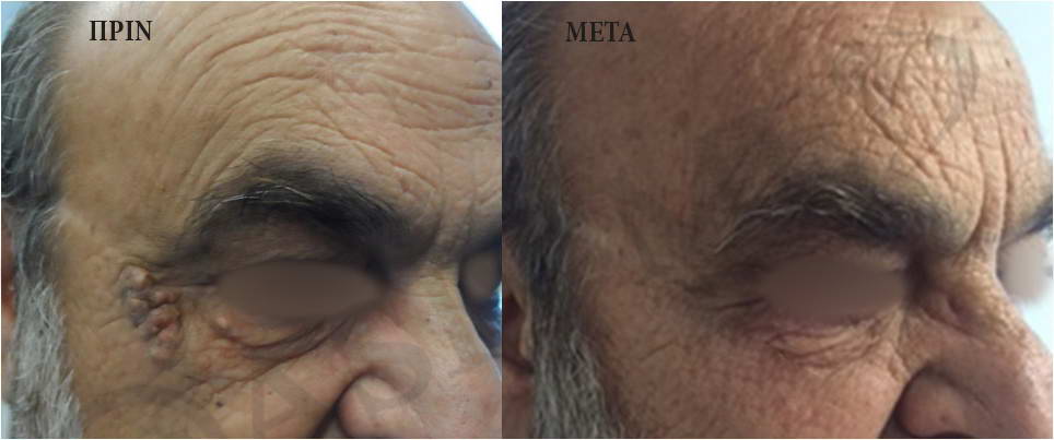 before after 2