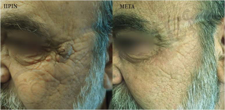 before after 3