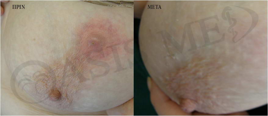 before after 4
