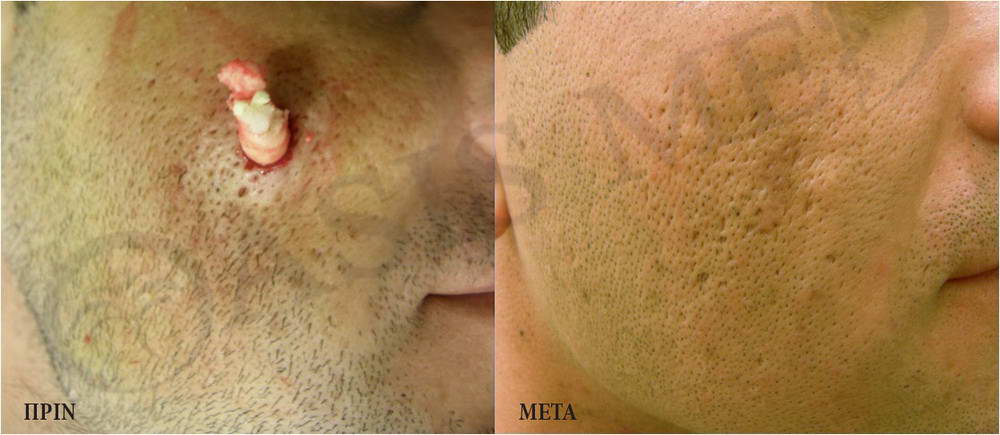 before after 5