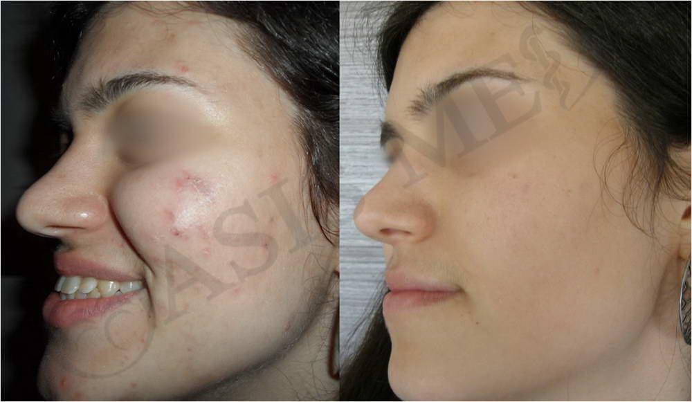 before after 27