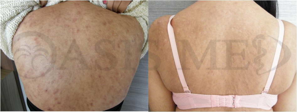 before after 29