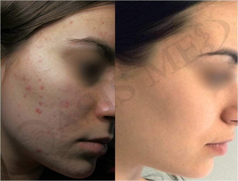before after 34