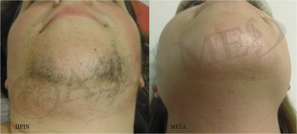 before after 7