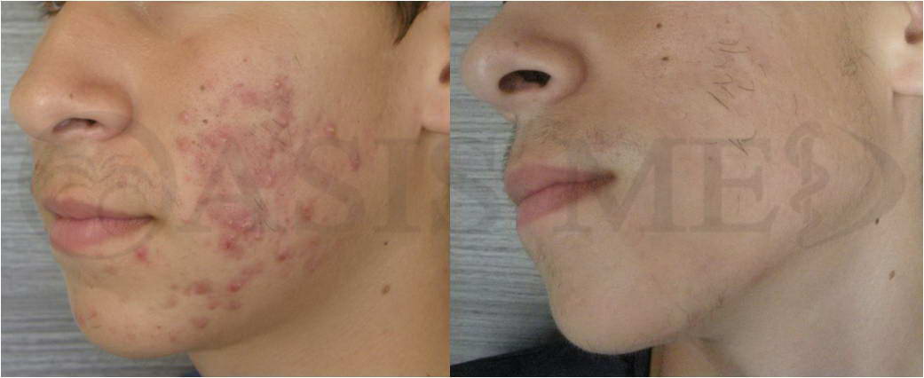 before after 21