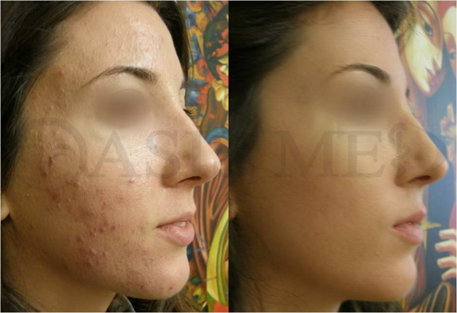 before after 3