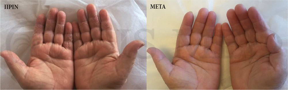before after 1