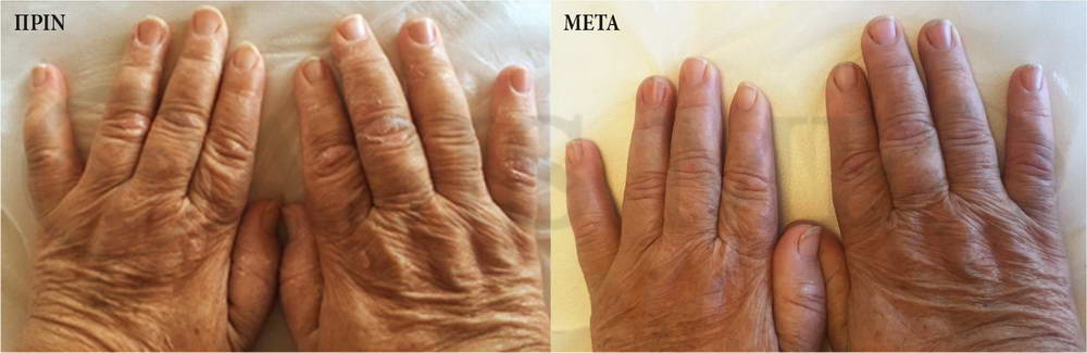 before after 2
