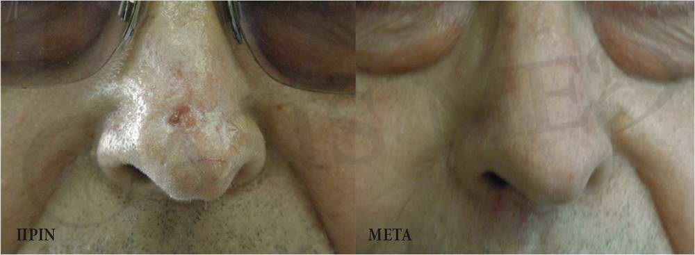 before after 2