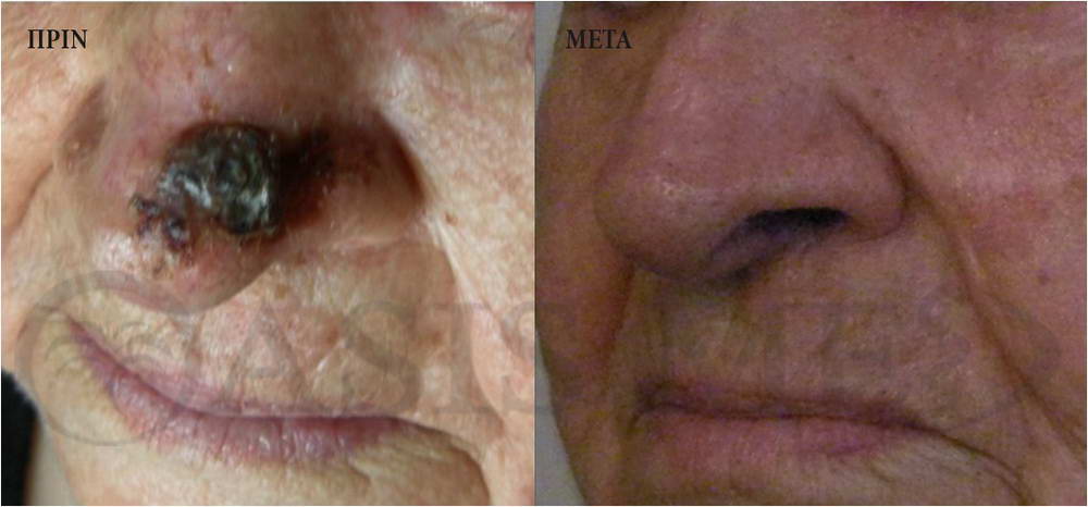 before after 3