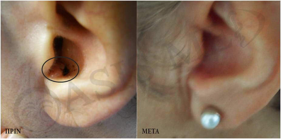 before after 4