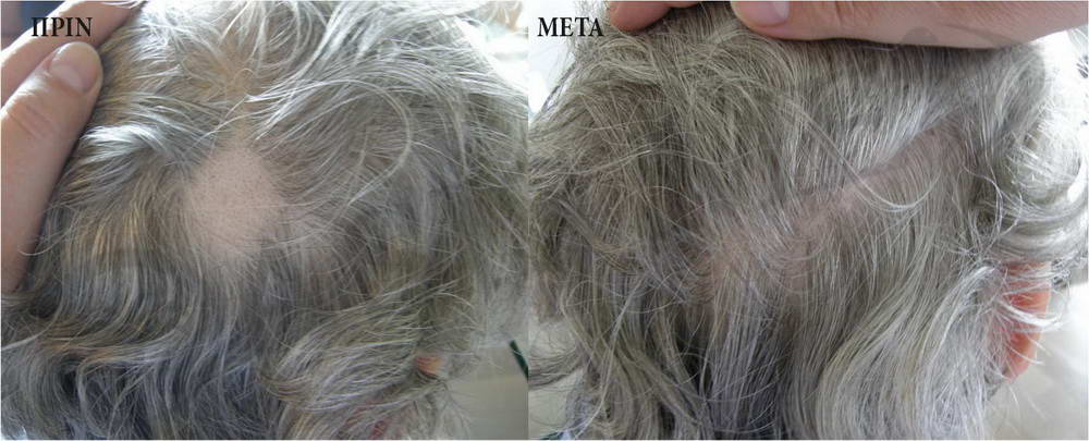 before after 2