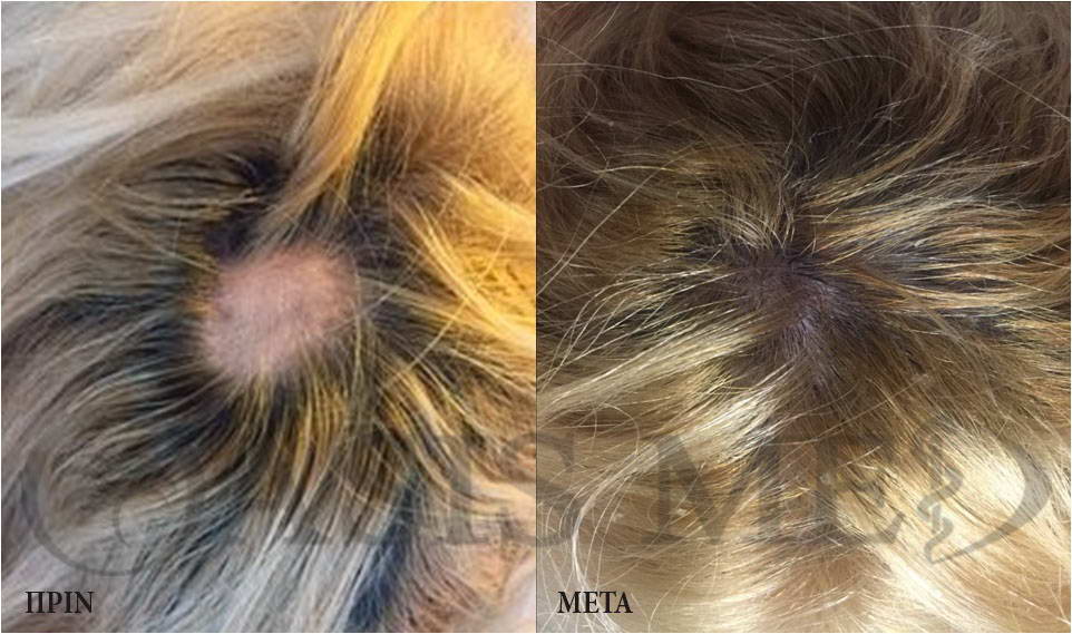 before after 3